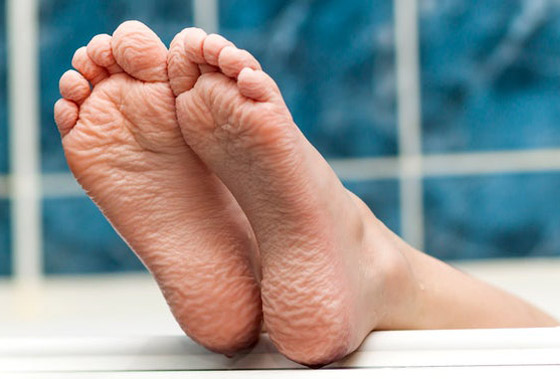 ما سبب تجعد الأصابع وانكماشها عند تعرضها للماء؟ صورة رقم 6