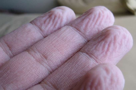 ما سبب تجعد الأصابع وانكماشها عند تعرضها للماء؟ صورة رقم 7