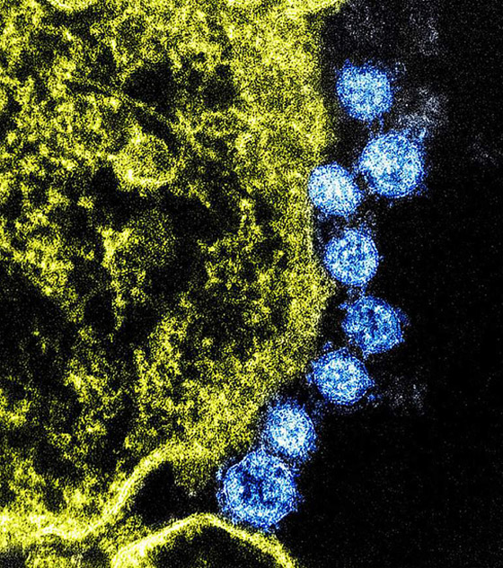 رغم التقدم العلمي.. لماذا لا يوجد لقاح لكورونا حتى الآن؟ صورة رقم 15