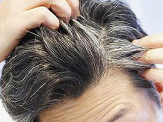 لماذا يشيب الشعر ويتحول لونه للرمادي أو الأبيض في سن مبكرة؟ صورة رقم 8