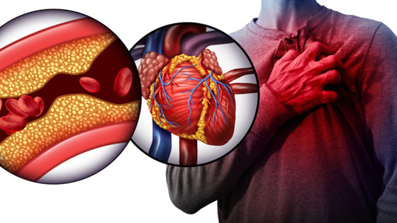 أبرز الخرافات والشائعات المنتشرة عن الكوليسترول التي يصدقها الكثيرون صورة رقم 4