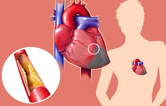 أبرز الخرافات والشائعات المنتشرة عن الكوليسترول التي يصدقها الكثيرون صورة رقم 8