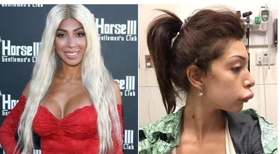 صور عمليات تجميل جنونية: امرأة أصبحت قطة ومهووس تحول لسوبر مان  صورة رقم 3