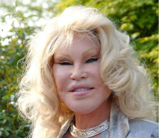 صور عمليات تجميل جنونية: امرأة أصبحت قطة ومهووس تحول لسوبر مان  صورة رقم 4