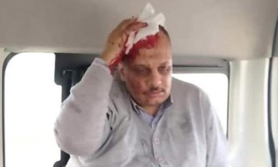طالب مصري يهدد بحرق كلية ويعتدي على أستاذه بمسدس! صورة رقم 2 طالب مصري يهدد بحرق كلية ويعتدي على أستاذه بمسدس! صورة رقم 2
