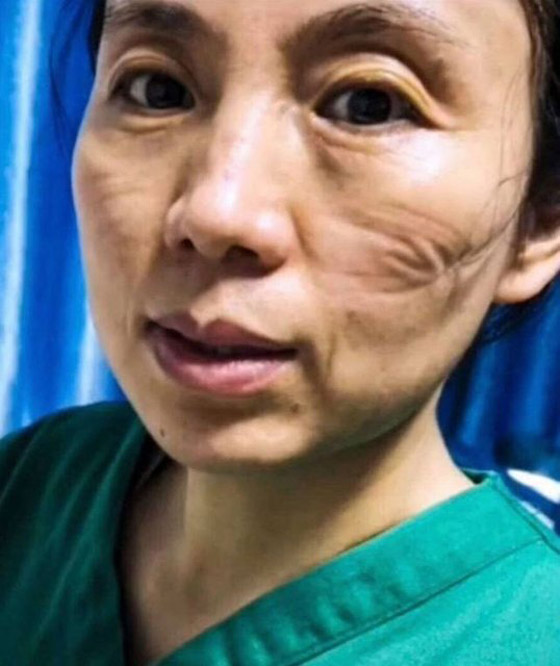 مشاهد مؤثرة لأطباء صينيين.. هيستيريا وانهيارات عصبية وأيام بلا نوم! صورة رقم 2