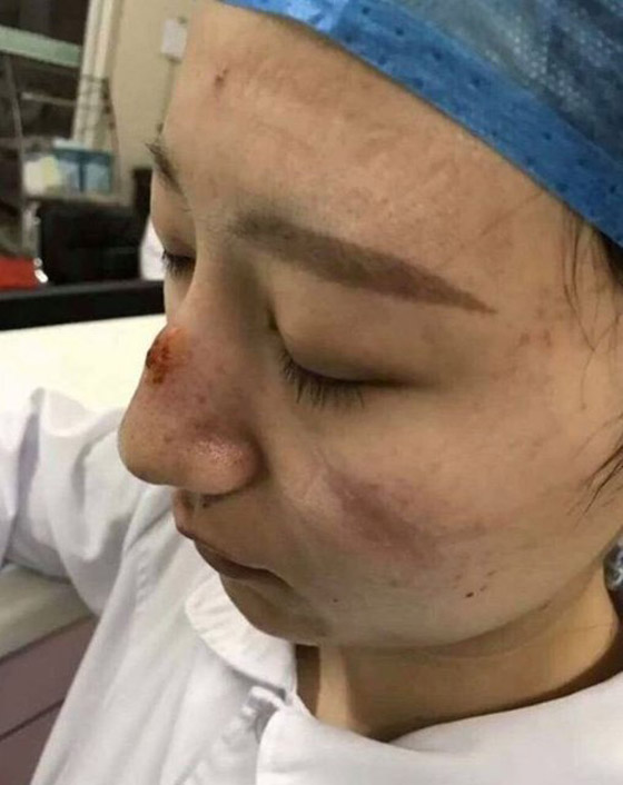 مشاهد مؤثرة لأطباء صينيين.. هيستيريا وانهيارات عصبية وأيام بلا نوم! صورة رقم 6