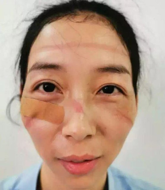 مشاهد مؤثرة لأطباء صينيين.. هيستيريا وانهيارات عصبية وأيام بلا نوم! صورة رقم 5