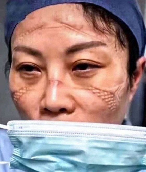 مشاهد مؤثرة لأطباء صينيين.. هيستيريا وانهيارات عصبية وأيام بلا نوم! صورة رقم 8