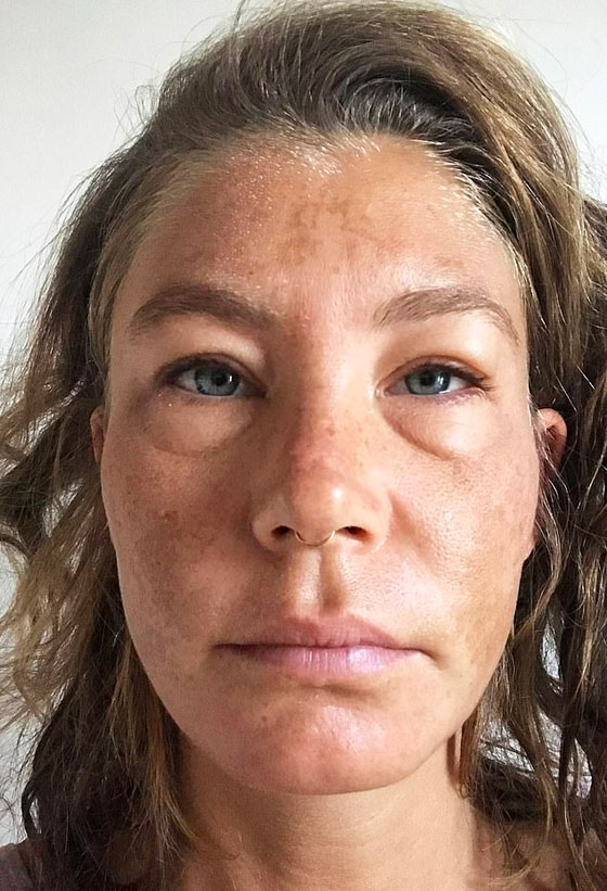 لم تشرب الماء منذ سنة.. والنتيجة مذهلة! (صور) صورة رقم 3