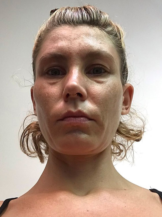 لم تشرب الماء منذ سنة.. والنتيجة مذهلة! (صور) صورة رقم 5