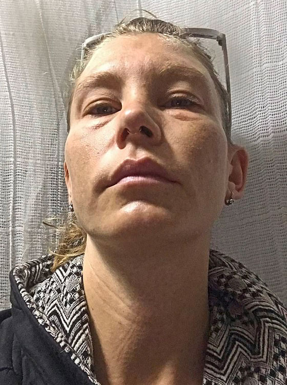 لم تشرب الماء منذ سنة.. والنتيجة مذهلة! (صور) صورة رقم 6