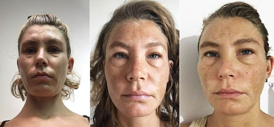 لم تشرب الماء منذ سنة.. والنتيجة مذهلة! (صور) صورة رقم 1