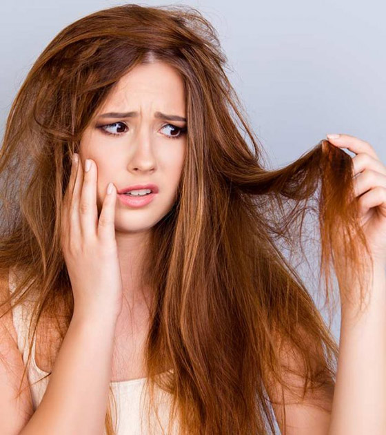 جفاف الشعر.. 5 علاجات منزلية سريعة وسهلة صورة رقم 1