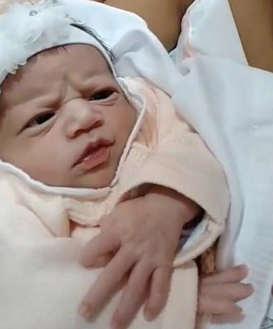 صور طريفة: طفلة تنظر بوجه غاضب إلى طبيبة التوليد في البرازيل صورة رقم 7