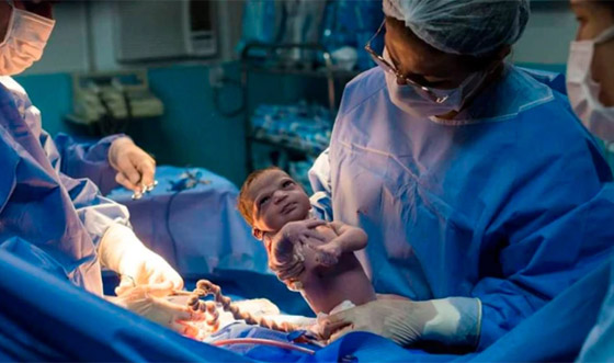 صور طريفة: طفلة تنظر بوجه غاضب إلى طبيبة التوليد في البرازيل صورة رقم 8