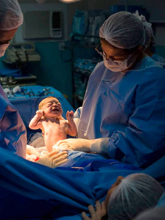 صور طريفة: طفلة تنظر بوجه غاضب إلى طبيبة التوليد في البرازيل صورة رقم 9