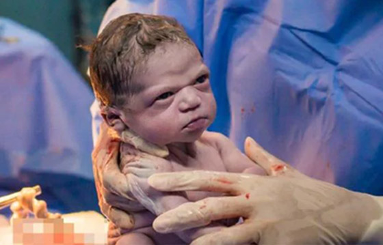 صور طريفة: طفلة تنظر بوجه غاضب إلى طبيبة التوليد في البرازيل صورة رقم 2