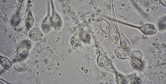 غرائب الطبيعة.. علماء يكتشفون أول كائن حي لا يتنفس! صورة رقم 5