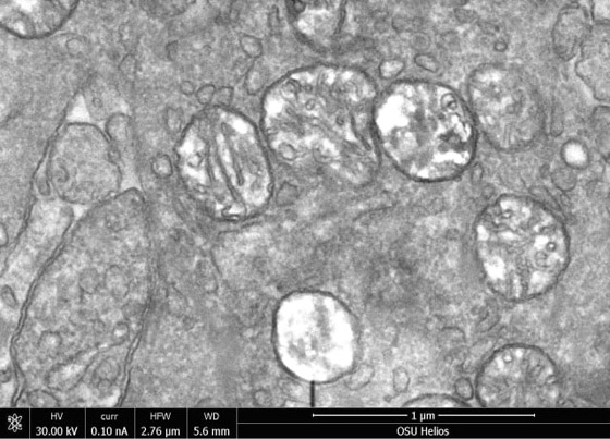 غرائب الطبيعة.. علماء يكتشفون أول كائن حي لا يتنفس! صورة رقم 7