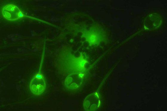 غرائب الطبيعة.. علماء يكتشفون أول كائن حي لا يتنفس! صورة رقم 10