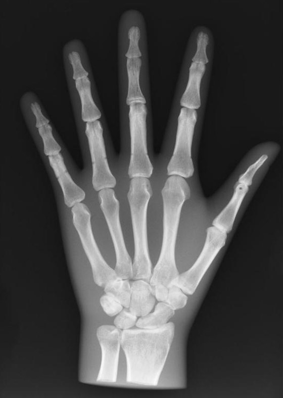 أهم الاكتشافات والاختراعات العلمية التي غيّرت مسار الإنسانية صورة رقم 5