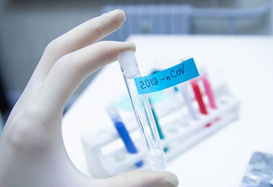 كيف ساهمت مواقع التواصل بنشر معلومات مغلوطة عن كورونا؟ صورة رقم 8