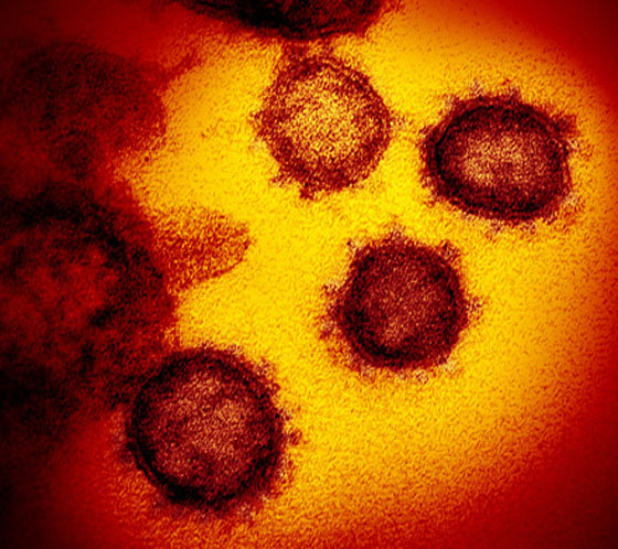 كيف ساهمت مواقع التواصل بنشر معلومات مغلوطة عن كورونا؟ صورة رقم 18