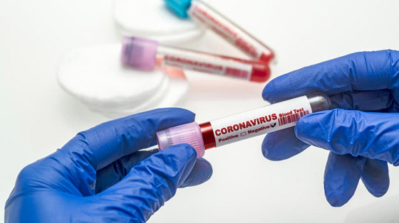 مجرمون يبيعون دماء المتعافين من فيروس كورونا عبر الإنترنت المظلم صورة رقم 9