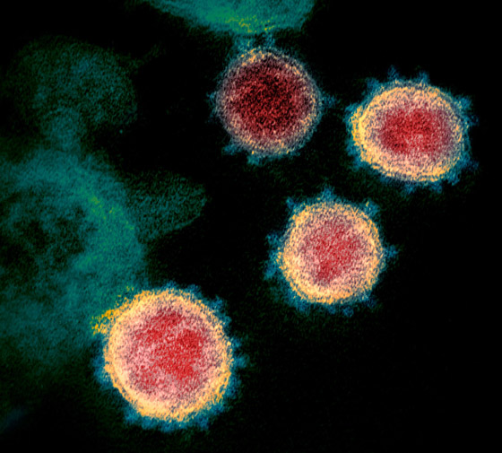 مجرمون يبيعون دماء المتعافين من فيروس كورونا عبر الإنترنت المظلم صورة رقم 14