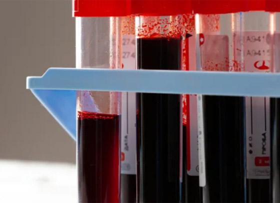 مجرمون يبيعون دماء المتعافين من فيروس كورونا عبر الإنترنت المظلم صورة رقم 17