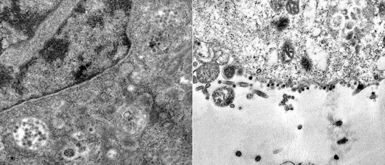 شاهد من مجهر إلكتروني أول رصد للفيروس وهو يمسك بالخلية صورة رقم 2