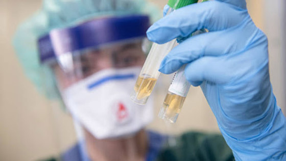 علماء فرنسيون درسوا كورونا ففاجأهم بقدرة لم يتصوروها صورة رقم 3