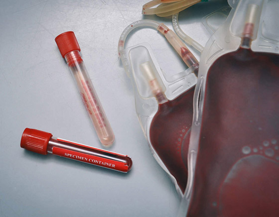 مجرمون يبيعون دماء المتعافين من فيروس كورونا عبر الإنترنت المظلم صورة رقم 6