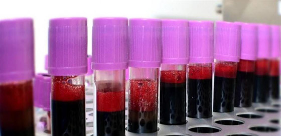 مجرمون يبيعون دماء المتعافين من فيروس كورونا عبر الإنترنت المظلم صورة رقم 8