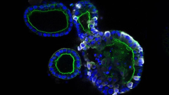 كشف أول صور تفصيلية تظهر شكل فيروس كورونا صورة رقم 2