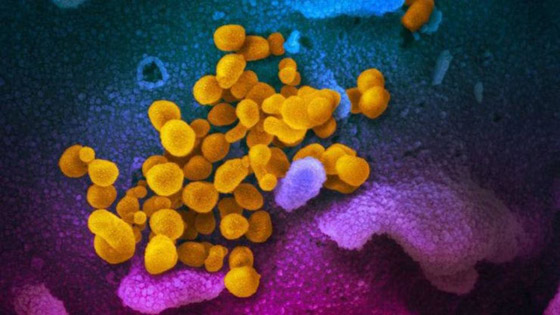 كشف أول صور تفصيلية تظهر شكل فيروس كورونا صورة رقم 3