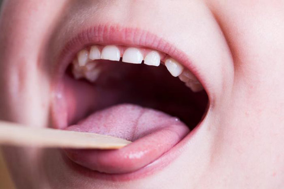 عشرات الأطفال يصابون بمرض التهابي نادر له علاقة بفيروس كورونا صورة رقم 8