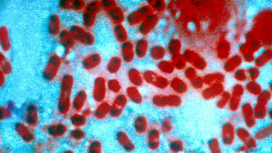 مخاوف من إرهاب بيولوجي بعد كورونا! وخطة كان بإمكانها إنقاذ العالم! صورة رقم 4