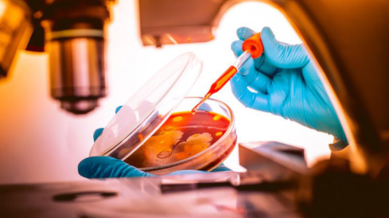 مخاوف من إرهاب بيولوجي بعد كورونا! وخطة كان بإمكانها إنقاذ العالم! صورة رقم 11