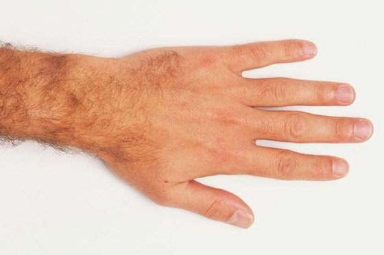 اصحاب أصابع الخنصر الأطول أقل عرضة للوفاة بـ«COVID-19» صورة رقم 2