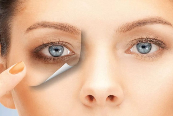 5 وصفات للتخلّص من الهالات السوداء حول العينين صورة رقم 2