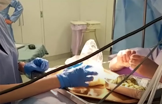 فيديو مثير: سيدة إيطالية تحضر وجبة شهيرة خلال عملية دماغ مفتوح خطيرة صورة رقم 4 فيديو مثير: سيدة إيطالية تحضر وجبة شهيرة خلال عملية دماغ مفتوح خطيرة صورة رقم 4
