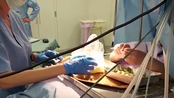 فيديو مثير: سيدة إيطالية تحضر وجبة شهيرة خلال عملية دماغ مفتوح خطيرة صورة رقم 2 فيديو مثير: سيدة إيطالية تحضر وجبة شهيرة خلال عملية دماغ مفتوح خطيرة صورة رقم 2