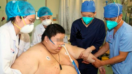 شاهد الرجل الذي زاد وزنه 100 كلغ لشدة خوفه من كورونا صورة رقم 2 شاهد الرجل الذي زاد وزنه 100 كلغ لشدة خوفه من كورونا صورة رقم 2