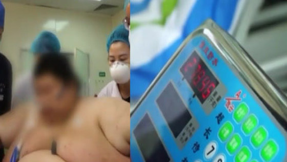 شاهد الرجل الذي زاد وزنه 100 كلغ لشدة خوفه من كورونا صورة رقم 7 شاهد الرجل الذي زاد وزنه 100 كلغ لشدة خوفه من كورونا صورة رقم 7