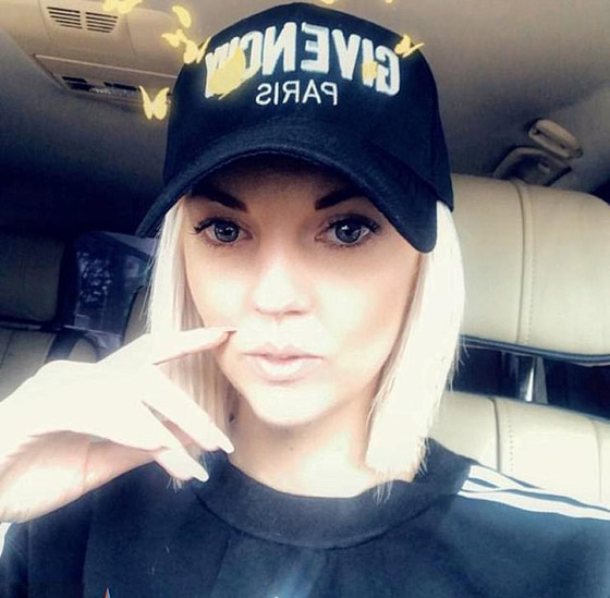 أجرت عملية لعلاج صوتها فاستفاقت وهي تتحدث 4 لغات ولهجات مختلفة! صورة رقم 3