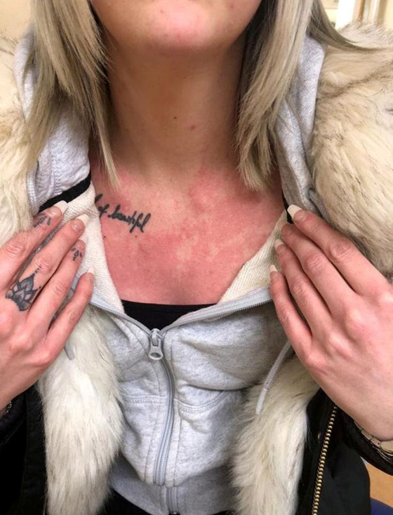 أجرت عملية لعلاج صوتها فاستفاقت وهي تتحدث 4 لغات ولهجات مختلفة! صورة رقم 2