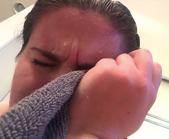 هل سمعت بمرض حساسية الماء؟ فتاة تعاني كلما استحمت أو غسلت يديها! صورة رقم 8