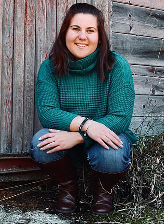 هل سمعت بمرض حساسية الماء؟ فتاة تعاني كلما استحمت أو غسلت يديها! صورة رقم 11